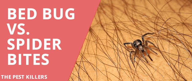 Bed bug vs Spider Bite – All you need to know
