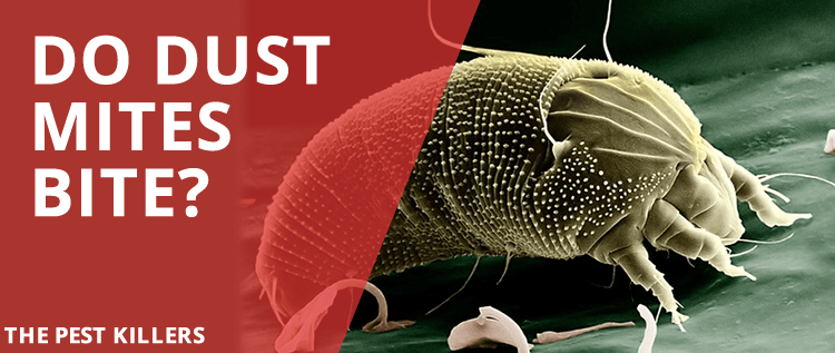 Dust Mite Bites – The allergy that looks like a bite