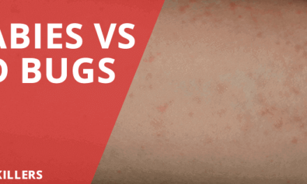 Scabies vs Bed Bugs – Skin Burrowing and Bite Marks